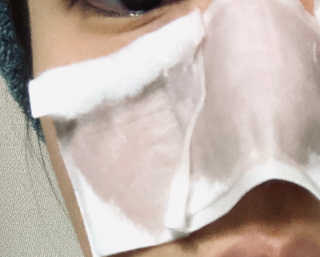 메디필 블랙 허니 세범 익스트렉터 — 5점을 준 리뷰어가 2020년 6월 올린 사용 사진