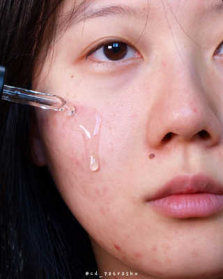 디마르3 알페 디 36 앰플 — 4.5점을 준 리뷰어가 2020년 11월 올린 사용 사진