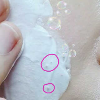 메디필 에스테 더마 유산균 콜라겐 클리어 — 4점을 준 리뷰어가 2020년 9월 올린 사용 사진