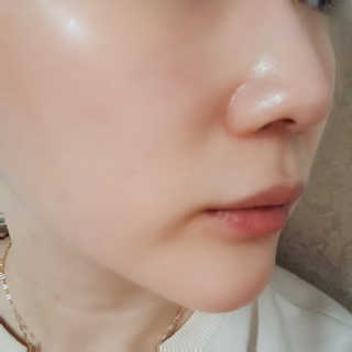 바베 BABE 바베 프로테오글리칸 F+F 앰플 솔루션 — 5점을 준 리뷰어가 2020년 8월 올린 사용 사진