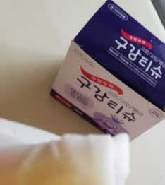 100도 이상에서 삶아 멸균 안심 아이수 구강 티슈 — 5점을 준 리뷰어가 2020년 11월 올린 사용 사진