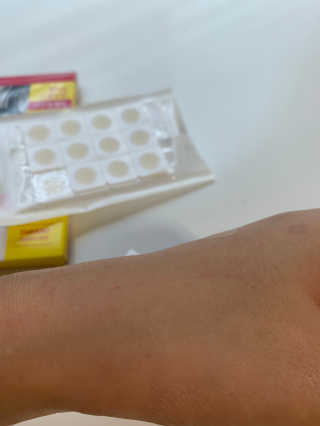 엘라밴드 하이드로 도트 스팟패치 12mm, 10mm — 5점을 준 리뷰어가 2020년 8월 올린 사용 사진