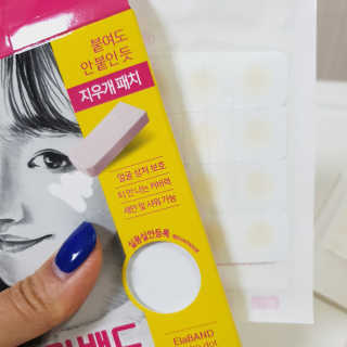 엘라밴드 하이드로 도트 스팟패치 12mm, 10mm — 5점을 준 리뷰어가 2020년 8월 올린 사용 사진
