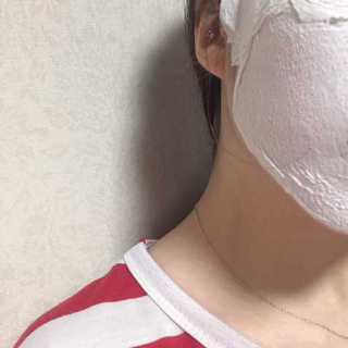 아이디플라코스메틱 페이스핏 플라스터 마스크 — 4점을 준 리뷰어가 2020년 6월 올린 사용 사진