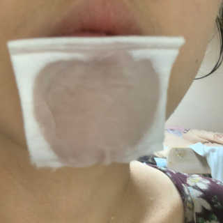메디필 블랙 허니 세범 익스트렉터 — 5점을 준 리뷰어가 2020년 6월 올린 사용 사진