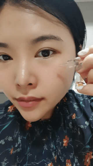 바베 BABE 바베 프로테오글리칸 F+F 앰플 솔루션 — 5점을 준 리뷰어가 2020년 9월 올린 사용 사진