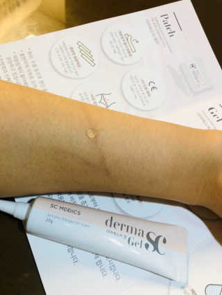 derma SC-Gel 더마에스씨 겔 20g — 4점을 준 리뷰어가 2020년 4월 올린 사용 사진