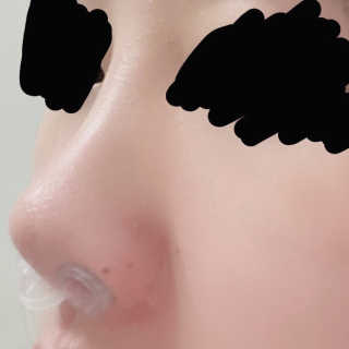 풋테크 코가 뻥 코스마일 1개입 — 5점을 준 리뷰어가 2020년 11월 올린 사용 사진