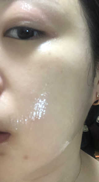 이너풀 하이 모이스처라이징 바이오셀룰로오스 마스크 — 5점을 준 리뷰어가 2020년 8월 올린 사용 사진