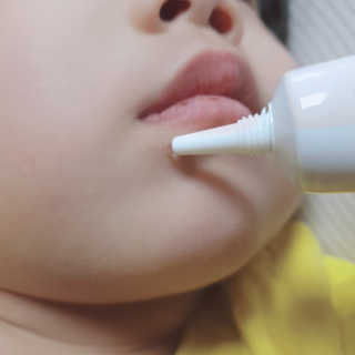 derma SC-Gel 더마에스씨 겔 20g — 4점을 준 리뷰어가 2020년 4월 올린 사용 사진
