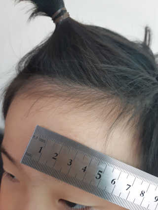 derma SC-Gel 더마에스씨 겔 20g — 4점을 준 리뷰어가 2020년 4월 올린 사용 사진