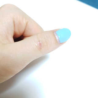 derma SC-Gel 더마에스씨 겔 20g — 5점을 준 리뷰어가 2020년 4월 올린 사용 사진