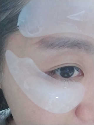 아이디플라코스메틱 아이디 페이스핏 플러스 패치 v2 — 3점을 준 리뷰어가 2020년 12월 올린 사용 사진