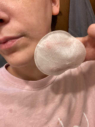 뷰트리 BEAUTREE PLA 버블 각질 제거 클렌징 패드 — 5점을 준 리뷰어가 2020년 9월 올린 사용 사진