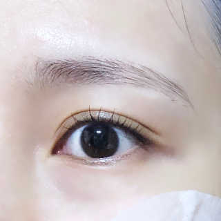 닥터존스킨 눈썹자라 — 4.5점을 준 리뷰어가 2020년 8월 올린 사용 사진