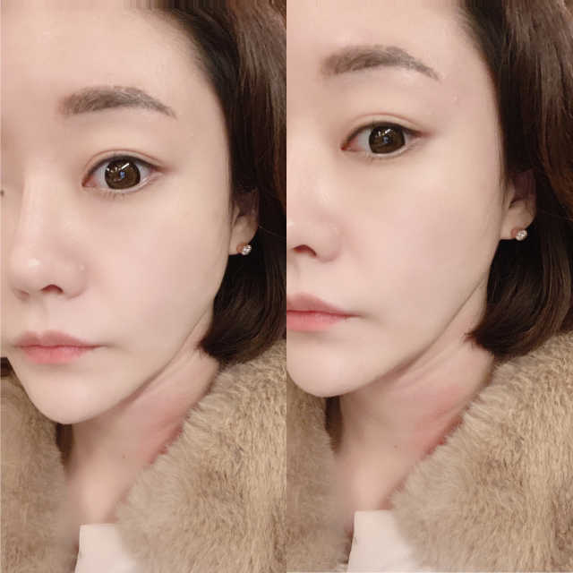 1ING[일링] 꽃발 이어링 리뷰 사진