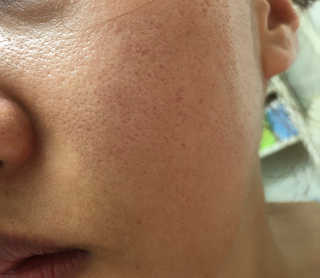 바이오믹 BIOMEEK SENSIMETIC MILD ACID CLEANSER — 5점을 준 리뷰어가 2020년 8월 올린 사용 사진
