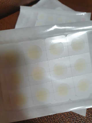 엘라밴드 하이드로 도트 스팟패치 12mm, 10mm — 5점을 준 리뷰어가 2020년 10월 올린 사용 사진
