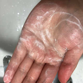 메디필 에스테 더마 유산균 콜라겐 클리어 — 5점을 준 리뷰어가 2020년 6월 올린 사용 사진