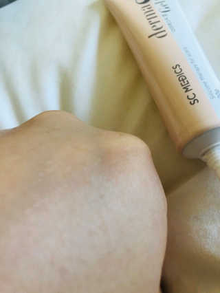 derma SC-Gel 더마에스씨 겔 20g — 5점을 준 리뷰어가 2020년 4월 올린 사용 사진