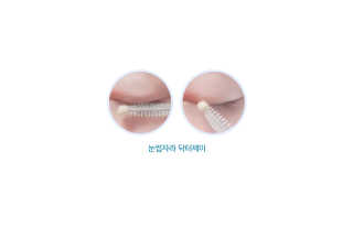 닥터존스킨 눈썹자라 — 4점을 준 리뷰어가 2020년 8월 올린 사용 사진