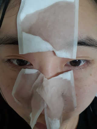 메디필 블랙 허니 세범 익스트렉터 — 5점을 준 리뷰어가 2020년 6월 올린 사용 사진