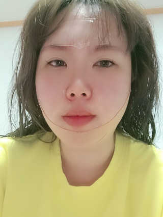 아이디플라코스메틱 아이디 페이스핏 마이너스 밴드 — 5점을 준 리뷰어가 2020년 5월 올린 사용 사진
