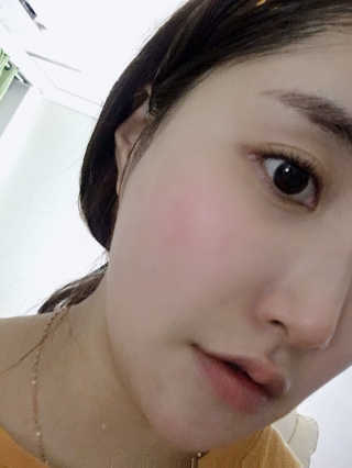 아이디플라코스메틱 페이스핏 플라스터 마스크 — 5점을 준 리뷰어가 2020년 6월 올린 사용 사진
