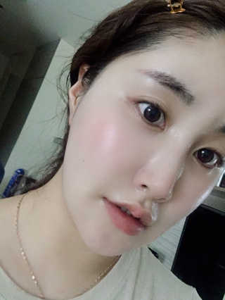 더말로지카 슈퍼 리치 리페어 — 5점을 준 리뷰어가 2020년 6월 올린 사용 사진