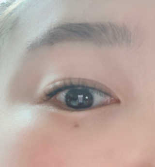 닥터존스킨 눈썹자라 — 3.5점을 준 리뷰어가 2020년 8월 올린 사용 사진