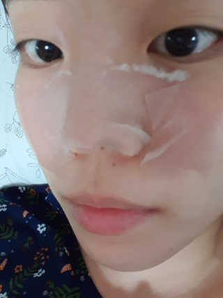 메디필 블랙 허니 세범 익스트렉터 — 3점을 준 리뷰어가 2020년 6월 올린 사용 사진