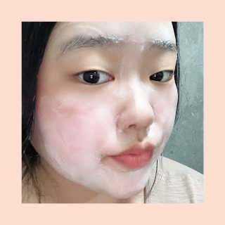 메디필 에스테 더마 유산균 콜라겐 클리어 — 4.5점을 준 리뷰어가 2020년 5월 올린 사용 사진