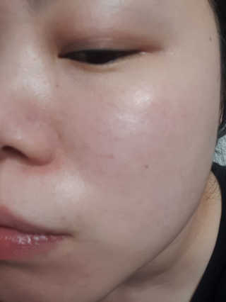 유닛브랜드 런슬로우 비타민 17 핑크 버블 스킨 부스터 — 3점을 준 리뷰어가 2020년 4월 올린 사용 사진
