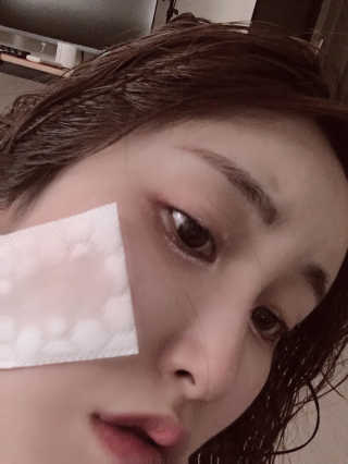 파머스시그니처 어성초, 작약뿌리, 흑미 추출물 3종 — 5점을 준 리뷰어가 2020년 9월 올린 사용 사진