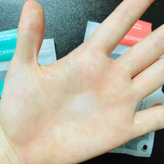 메디펜스 클린 핸드 세럼  2종 랜덤증정 — 5점을 준 리뷰어가 2020년 9월 올린 사용 사진