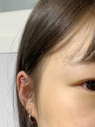엘라밴드 하이드로 도트 스팟패치 12mm, 10mm — 5점을 준 리뷰어가 2020년 9월 올린 사용 사진