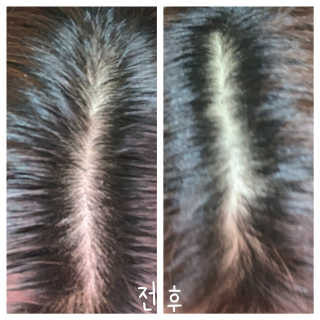 똥비님이 올린 리뷰 사진 2