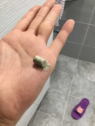 천사연구소 진짜 生병풀잎을 그대로  갈아 넣은 워시오프 센텔라팩 — 5점을 준 리뷰어가 2020년 7월 올린 사용 사진