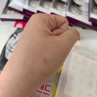 엘라밴드 하이드로 도트 스팟패치 12mm, 10mm — 5점을 준 리뷰어가 2020년 11월 올린 사용 사진