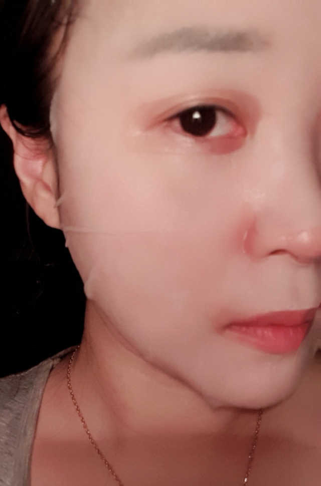 큐템 레이저 마스크 리뷰 사진