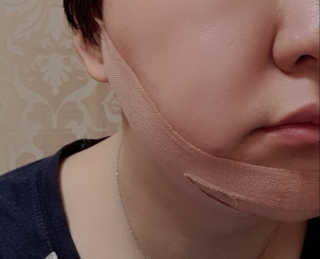 아이디플라코스메틱 아이디 페이스핏 마이너스 밴드 — 5점을 준 리뷰어가 2020년 4월 올린 사용 사진