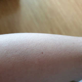 [블랙루즈] 줌 인 HD 커버핏 컨실러 3종 中 택1 — 4점을 준 리뷰어가 2020년 7월 올린 사용 사진
