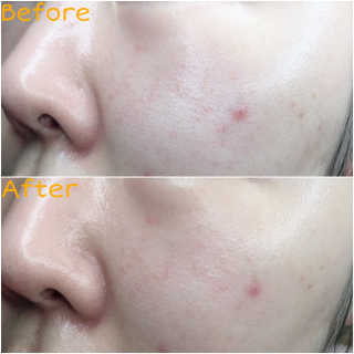 네이처컬렉션 이자녹스 UV 선 프로 365 익스트림 선 플루이드 100ml — 3점을 준 리뷰어가 2020년 5월 올린 사용 사진