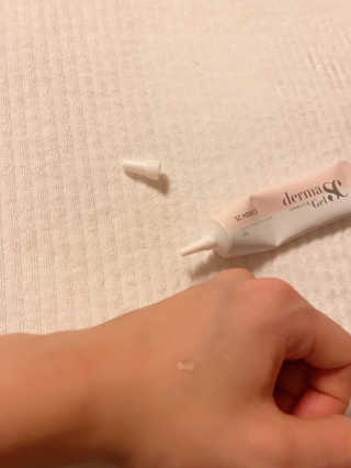 derma SC-Gel 더마에스씨 겔 20g — 5점을 준 리뷰어가 2020년 5월 올린 사용 사진
