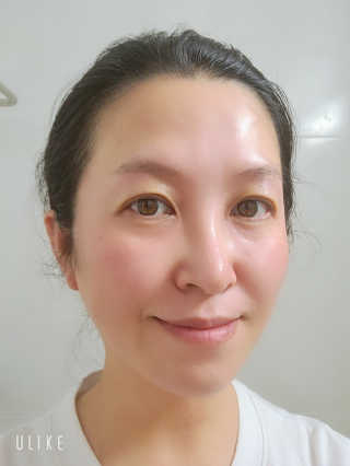 메디필 에스테 더마 유산균 콜라겐 클리어 — 4점을 준 리뷰어가 2020년 5월 올린 사용 사진