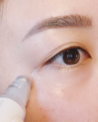 [오지랩] 애교살을 원하는 당신을 위해, 애교롤 — 4점을 준 리뷰어가 2020년 11월 올린 사용 사진