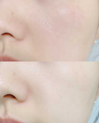 어글리프루프 에센스 스탑디어글리 레드모먼트 에센스 120ml — 4점을 준 리뷰어가 2020년 10월 올린 사용 사진
