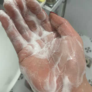 메디필 에스테 더마 유산균 콜라겐 클리어 — 4점을 준 리뷰어가 2020년 7월 올린 사용 사진