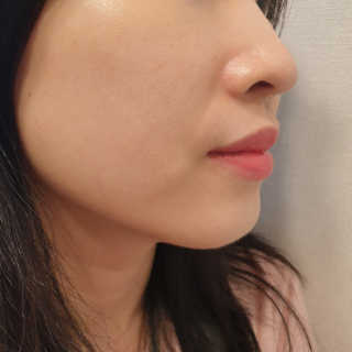 세렌디뷰티 레드 프로폴리스 트리플 미스트 — 4점을 준 리뷰어가 2020년 7월 올린 사용 사진