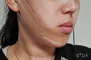 아이디플라코스메틱 아이디 페이스핏 마이너스 밴드 — 4점을 준 리뷰어가 2020년 4월 올린 사용 사진